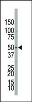 PIP5K2B Antibody (C-term)