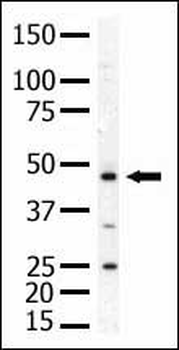 PIP4KII-alpha (PIP4K2A) Antibody (N-term)