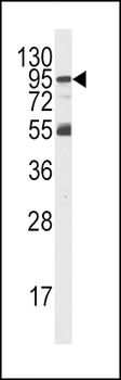 PI3KR5 Antibody (Center)