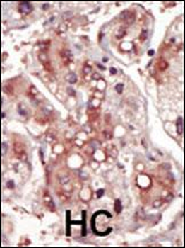 MEK2 (MAP2K2) Antibody (Center)