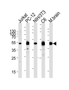 MEK1 (MAP2K1) Antibody (N-term)