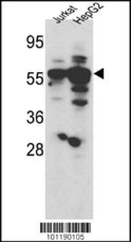 SGK3 Antibody (Center)