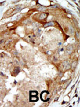 SGK3 Antibody (Center)