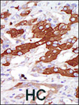 SGK3 Antibody (N-term)