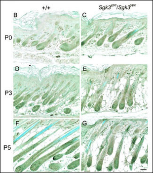 SGK3 Antibody (N-term)