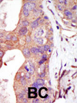 PRK2 Antibody (C-term)