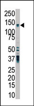 PKD2 Antibody (C-term)