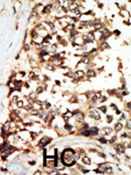 PKD2 Antibody (C-term)