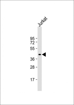 PIM1 Antibody (C-term)