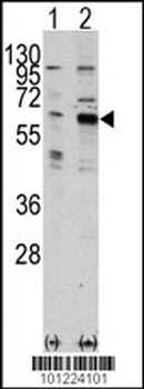 PAK3 Antibody (Center K218)