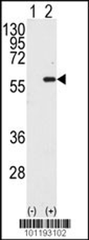 MST1 Antibody (C-term)