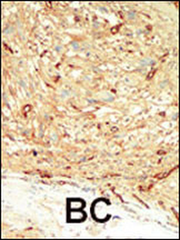 MST1 Antibody (C-term)