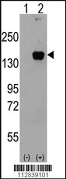 MAP3K5 Antibody(T842)