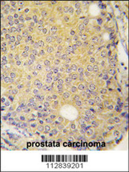 MAP3K5 Antibody(T842)