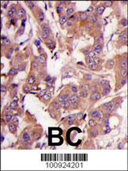 MEK1 (MAP2K1) Antibody (N-term)