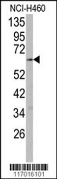 CYP2R1 Antibody (C-term)
