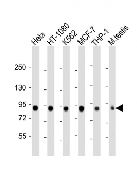 TBK1 Antibody (S172)