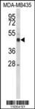 CYP21A2 Antibody (Center)