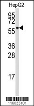 ALDH4A1 Antibody (Center)