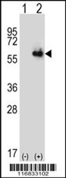 ALDH4A1 Antibody (Center)
