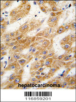 ALDH4A1 Antibody (C-term)