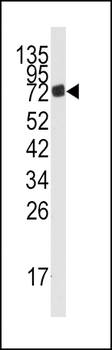AMPD3 Antibody (Center)