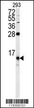 FKBP1B Antibody (N-term)