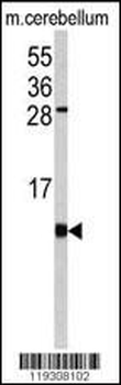 FKBP1B Antibody (N-term)