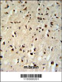 FKBP1B Antibody (N-term)