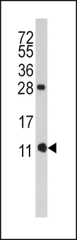 FKBP1B Antibody (N-term E6)