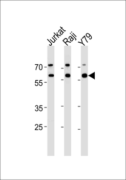 ACHE Antibody (N-term)