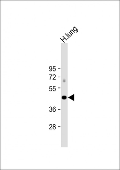 ALDH3A1 Antibody (Center)