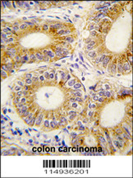 YARS2 Antibody (C-term)