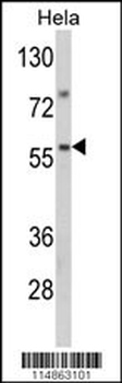 SARS2 Antibody (Center)