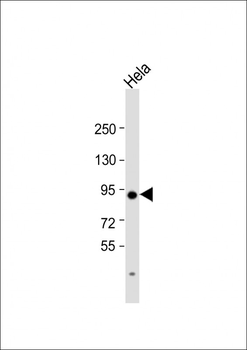 Transglutaminase (TGM2) Antibody (Center K444)