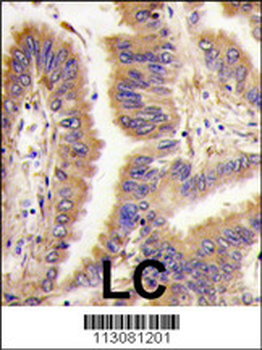 Transglutaminase (TGM2) Antibody (Center K444)