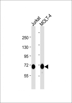ZAP70 Antibody (Center)