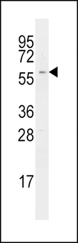 RIPK2 Antibody (C-term)