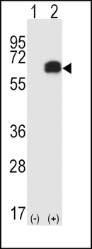 RIPK2 Antibody (C-term)