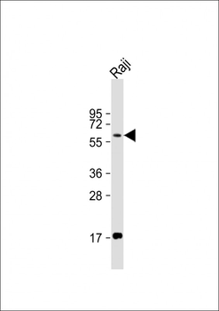 RIPK2 Antibody (C-term)