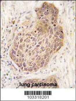 RIPK2 Antibody (C-term)