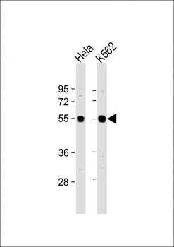IRAK4 Antibody (N-term)