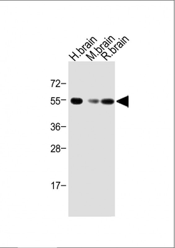 Activin A Receptor Type IB (ACVR1B) Antibody (N-term)