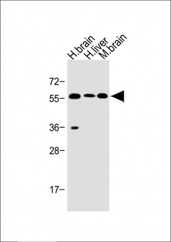 Activin A Receptor Type IB (ACVR1B) Antibody (N-term)