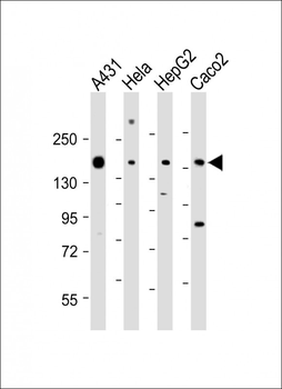 CCK4 (PTK7) Antibody (N-term)