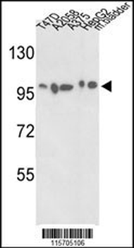ACTN4 Antibody (C-term)