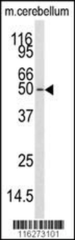 CAMKK1 Antibody (N-term)