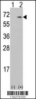 CAMKK1 Antibody (N-term)