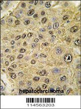 HIF1Alpha Antibody (C-term)