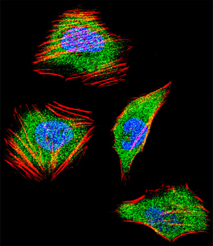 SMAD4 Antibody (C-term)